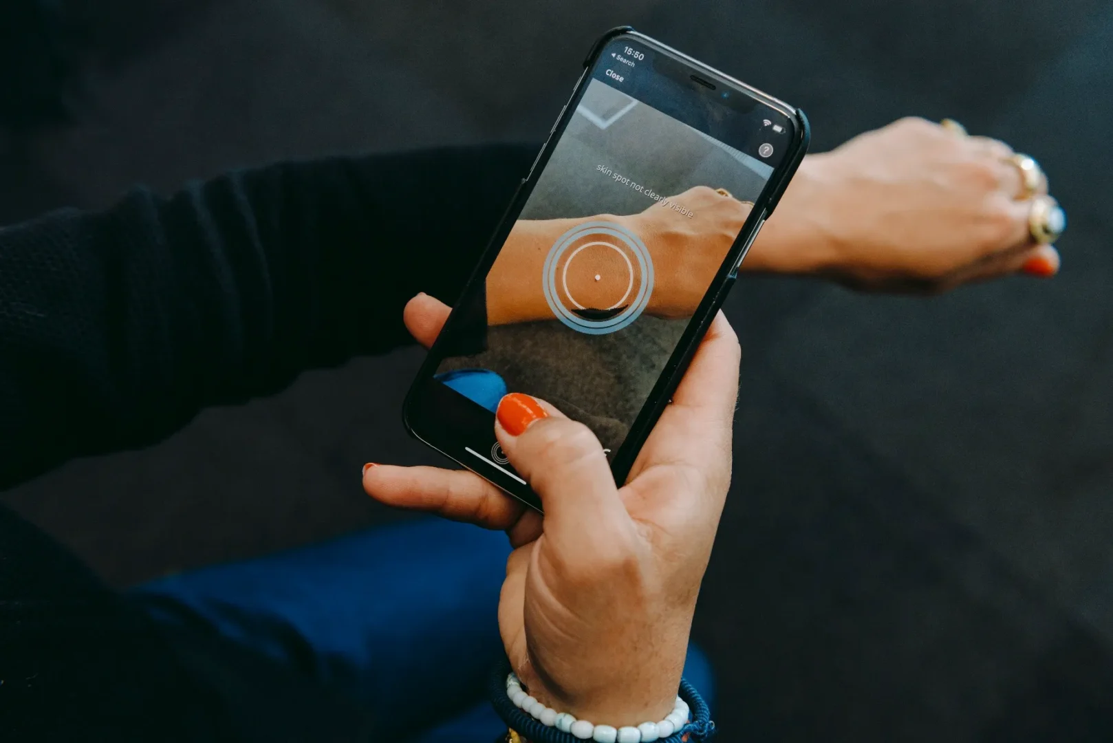 🧬 SkinVision تشخیص سرطان پوست، فقط با یک عکس آسان: باشگاه طراحی و پرورش محصول 🧬 SkinVision: تشخیص سرطان پوست، فقط با یک عکس