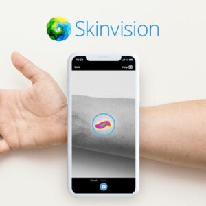 🧬 SkinVision: تشخیص سرطان پوست، فقط با یک عکس 🧬 SkinVision تشخیص سرطان پوست، فقط با یک عکس آسان: باشگاه طراحی و پرورش محصول 🧬 SkinVision: تشخیص سرطان پوست، فقط با یک عکس