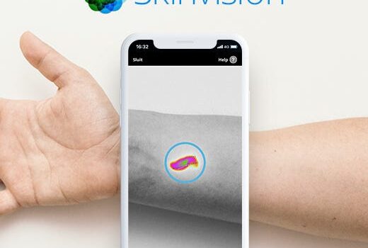 🧬 SkinVision تشخیص سرطان پوست، فقط با یک عکس آسان: باشگاه طراحی و پرورش محصول 🧬 SkinVision: تشخیص سرطان پوست، فقط با یک عکس